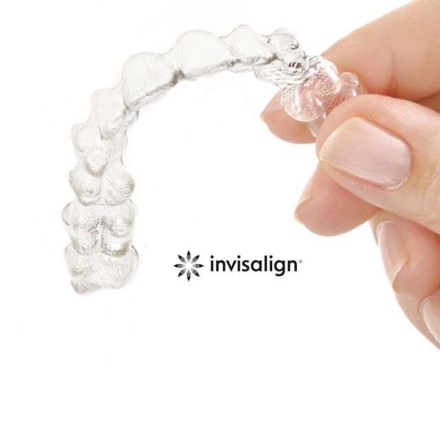 Invisalign - die transparente Zahnspange für Erwachsene