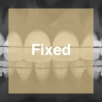 Fixed Braces